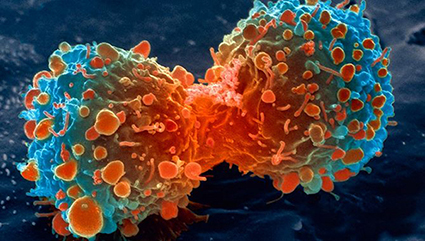 lung-cancer-cell-dividing-2